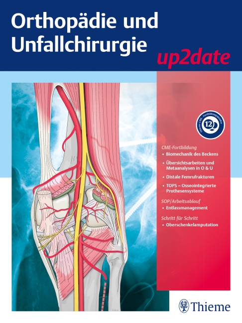 Orthopädie und Unfallchirurgie up2date