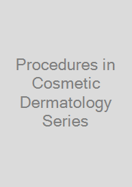 Procedures in Cosmetic Dermatology Series