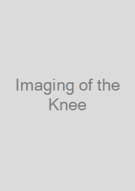 Imaging of the Knee