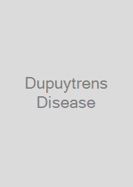 Dupuytrens Disease