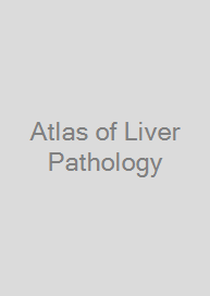 Atlas of Liver Pathology