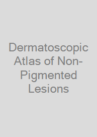 Dermatoscopic Atlas of Non-Pigmented Lesions