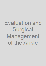 Cover Evaluation and Surgical Management of the Ankle