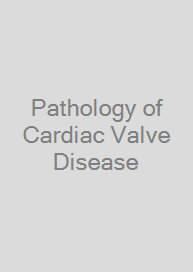 Pathology of Cardiac Valve Disease