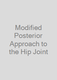 Cover Modified Posterior Approach to the Hip Joint