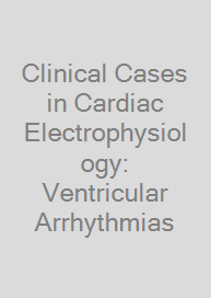 Clinical Cases in Cardiac Electrophysiology: Ventricular Arrhythmias