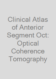 Clinical Atlas of Anterior Segment Oct: Optical Coherence Tomography