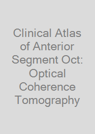 Cover Clinical Atlas of Anterior Segment Oct: Optical Coherence Tomography