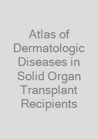 Atlas of Dermatologic Diseases in Solid Organ Transplant Recipients