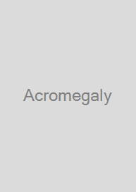 Acromegaly