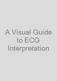 A Visual Guide to ECG Interpretation