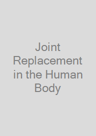 Cover Joint Replacement in the Human Body