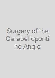 Cover Surgery of the Cerebellopontine Angle