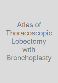 Cover Atlas of Thoracoscopic Lobectomy with Bronchoplasty