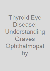 Thyroid Eye Disease: Understanding Graves Ophthalmopathy