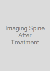 Imaging Spine After Treatment
