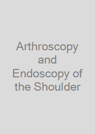 Arthroscopy and Endoscopy of the Shoulder