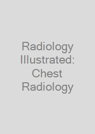 Cover Radiology Illustrated: Chest Radiology