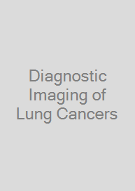 Cover Diagnostic Imaging of Lung Cancers