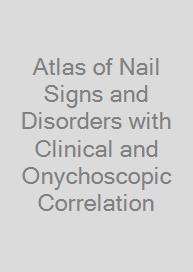Cover Atlas of Nail Signs and Disorders with Clinical and Onychoscopic Correlation