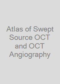 Atlas of Swept Source OCT and OCT Angiography