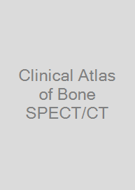 Clinical Atlas of Bone SPECT/CT