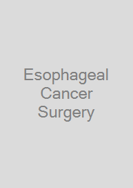 Esophageal Cancer Surgery