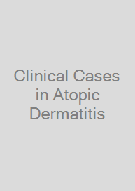 Clinical Cases in Atopic Dermatitis