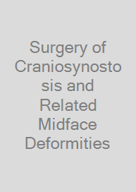 Cover Surgery of Craniosynostosis and Related Midface Deformities