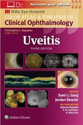 Cover Uveitis